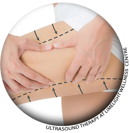 Cellulite Therapy in Vancouver