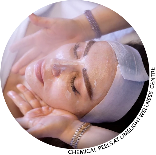 Chemical Peels in Vancouver