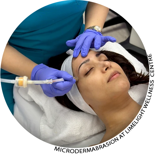 Microdermabrasion in Vancouver