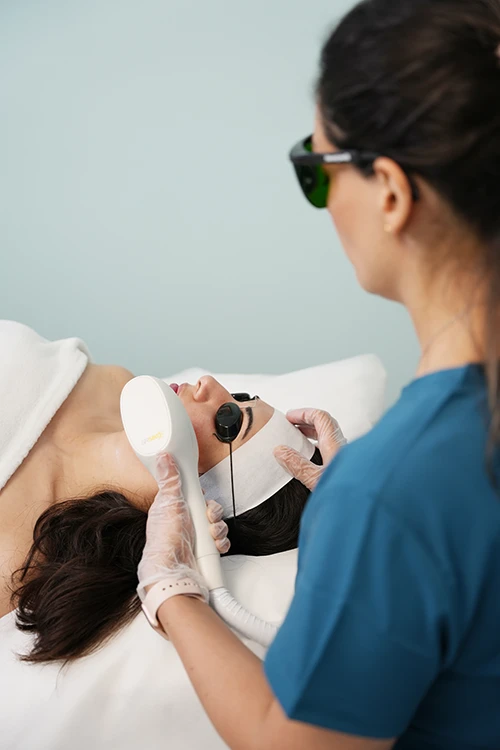 RF Microneedling in Vancouver
