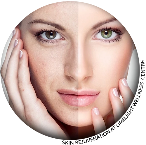Skin Rejuvenation in Vancouver