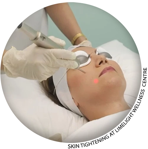 Skin Tightening in Vancouver