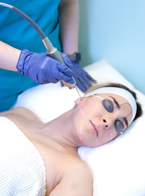 Skin Tightening in Vancouver