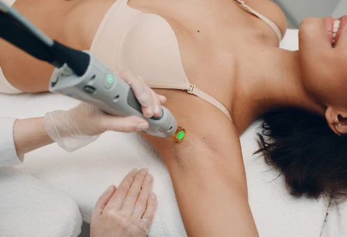 Why You Should Consider Laser Hair Removal