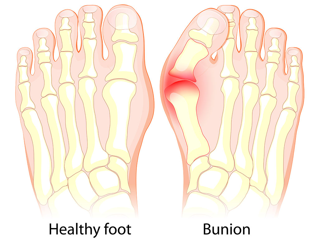 Ankle and Foot Therapy