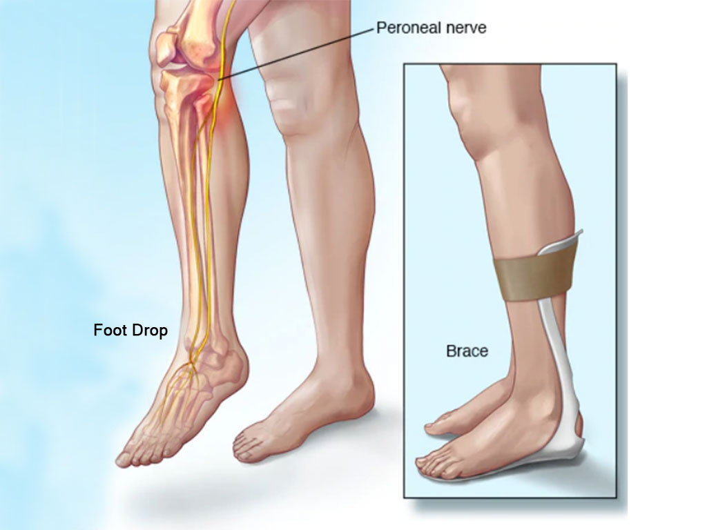 Ankle and Foot Therapy