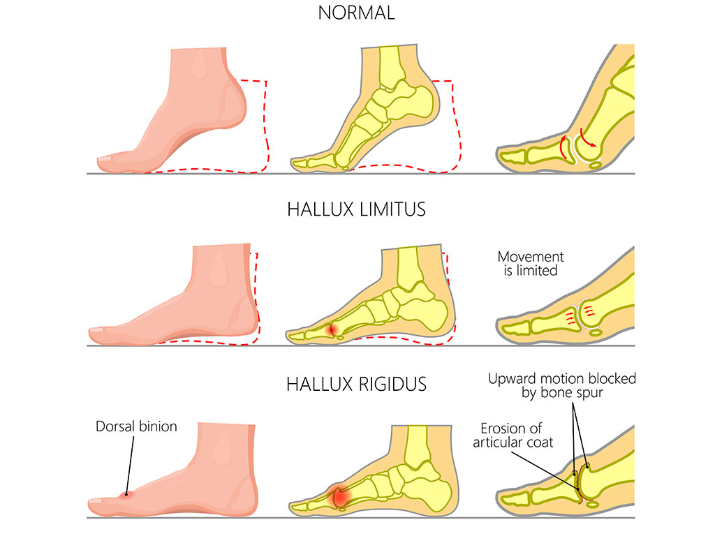 Ankle and Foot Therapy