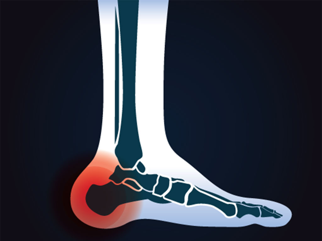 Ankle and Foot Therapy