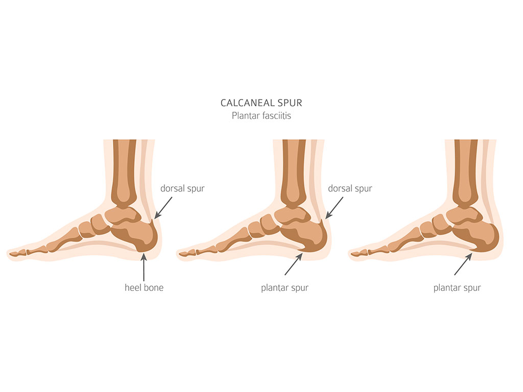 Ankle and Foot Therapy
