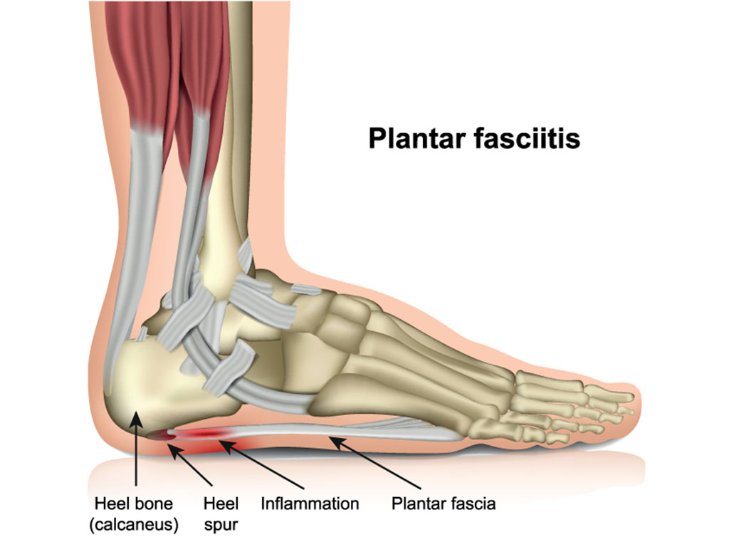 Ankle and Foot Therapy