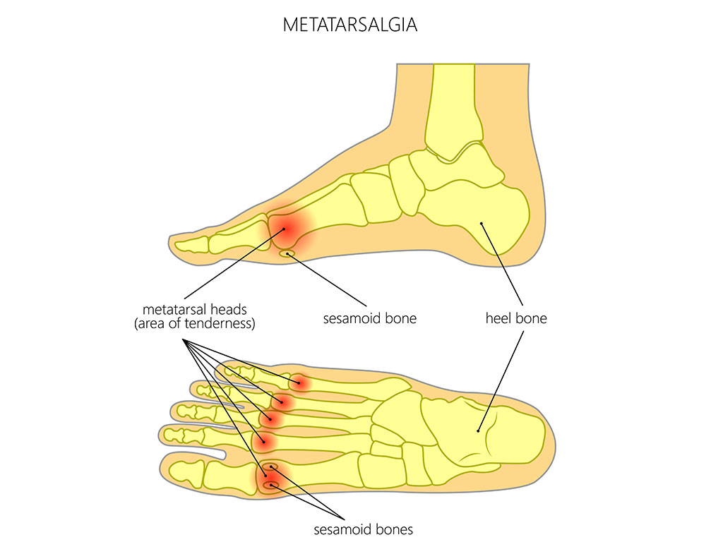 Ankle and Foot Therapy