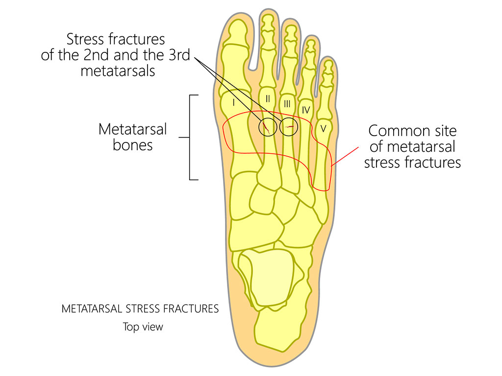 Ankle and Foot Therapy