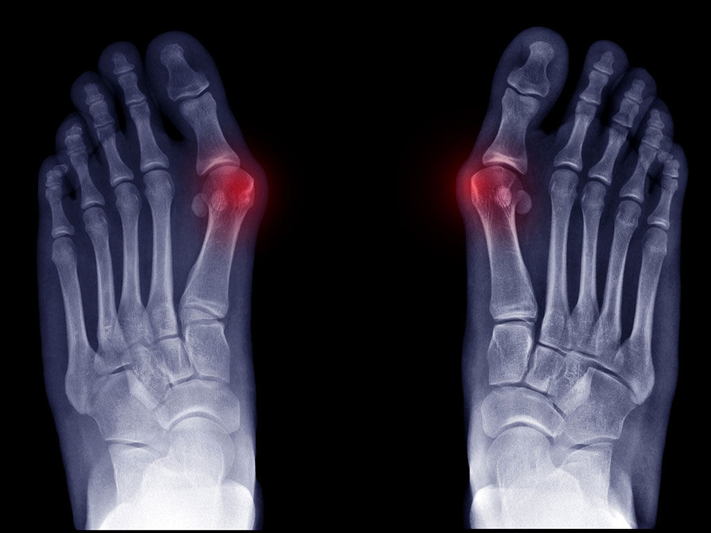 Ankle and Foot Therapy