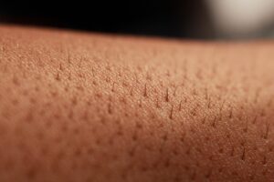 Why You Should Consider Laser Hair Removal Laser Hair Removal in Vancouver at Limelight Wellness Centre