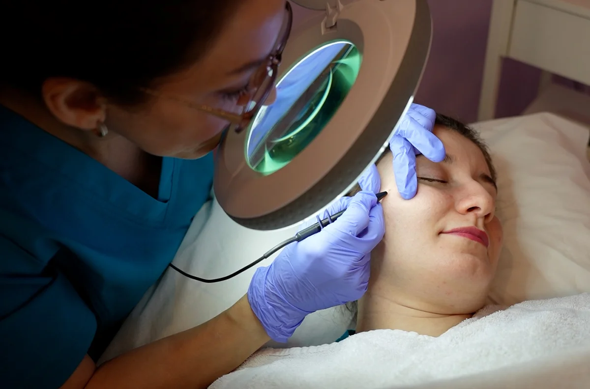 Hyperpigmentation Treatment