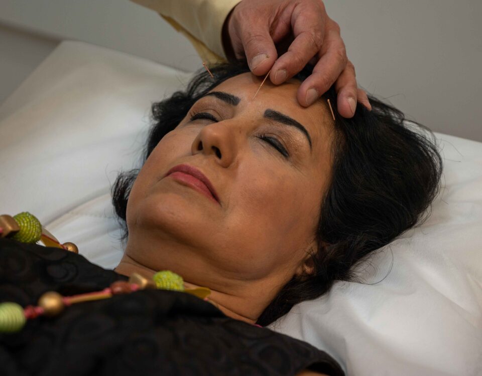 Acupuncture’s Benefits: Wellness and Skin Health at Limelight