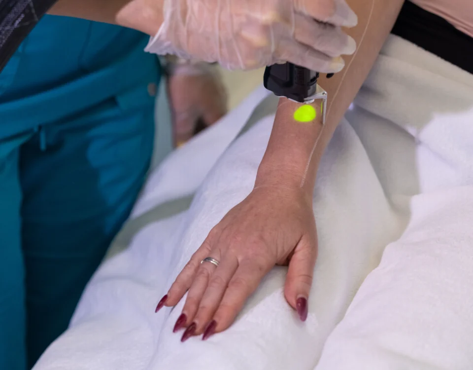 Why Laser Hair Removal Is Vancouver’s Top Choice for Smooth Skin
