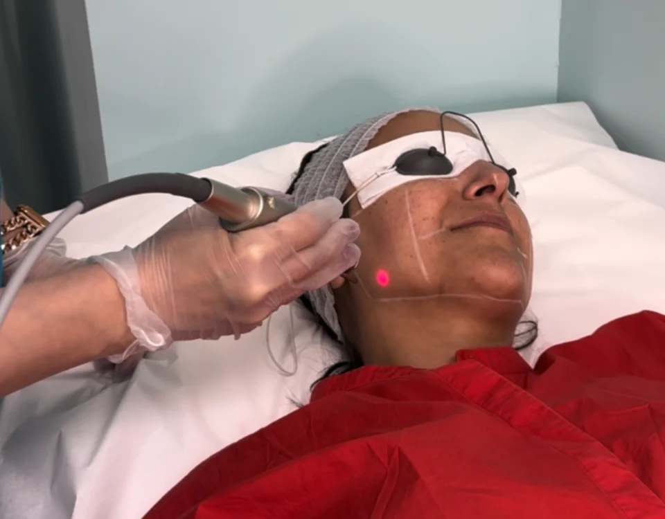 How RF Skin Tightening Delivers Natural Rejuvenation in Vancouver