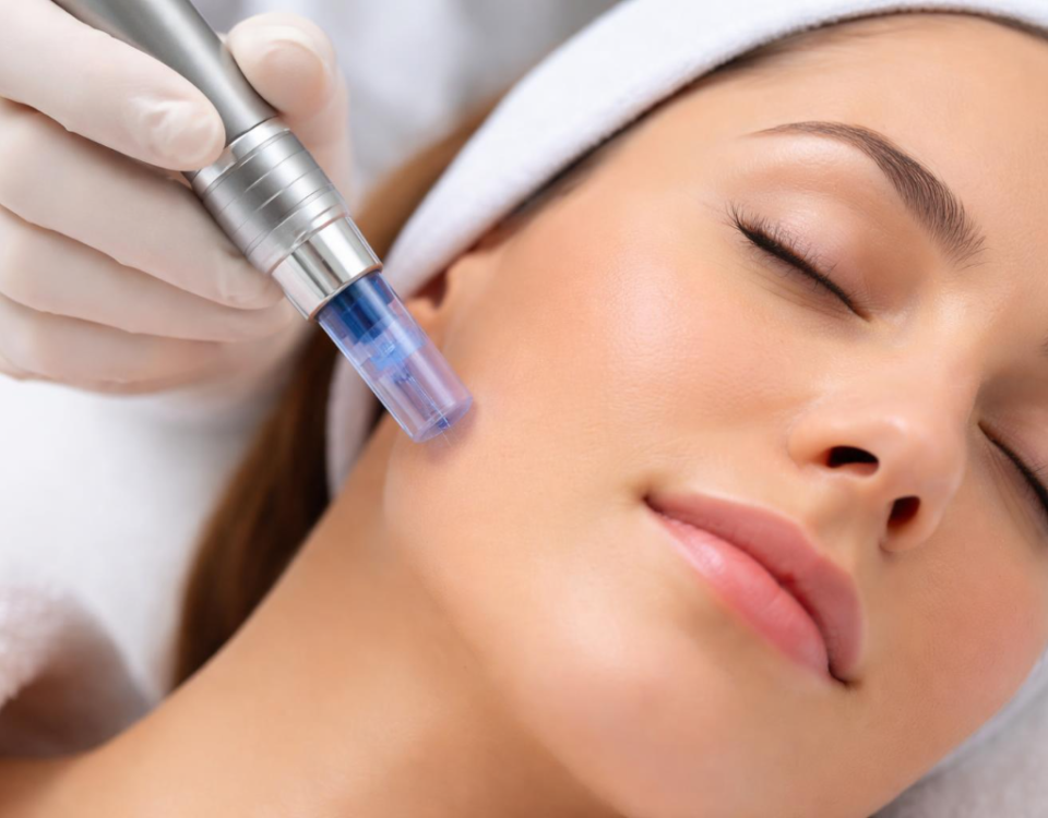 Microneedling Myths vs Reality: What the Treatment Is Really Like